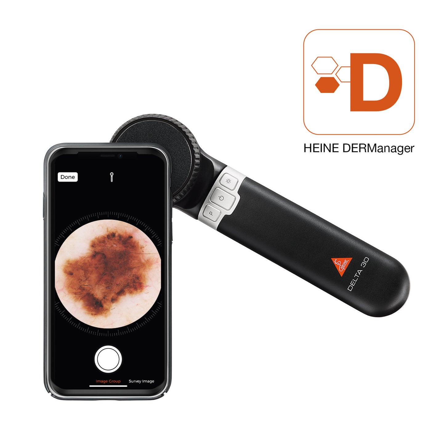 HEINE DELTA 30 Dermatoskop